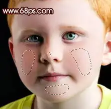 photoshop完美的消除小男孩满脸的斑点