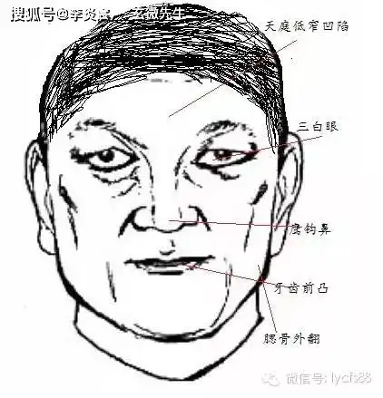 男子面相缺陷不能嫁