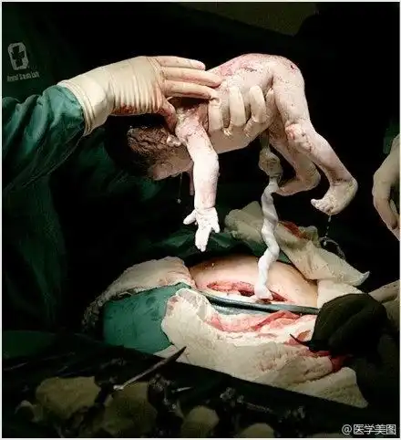 45张妇科医学图片