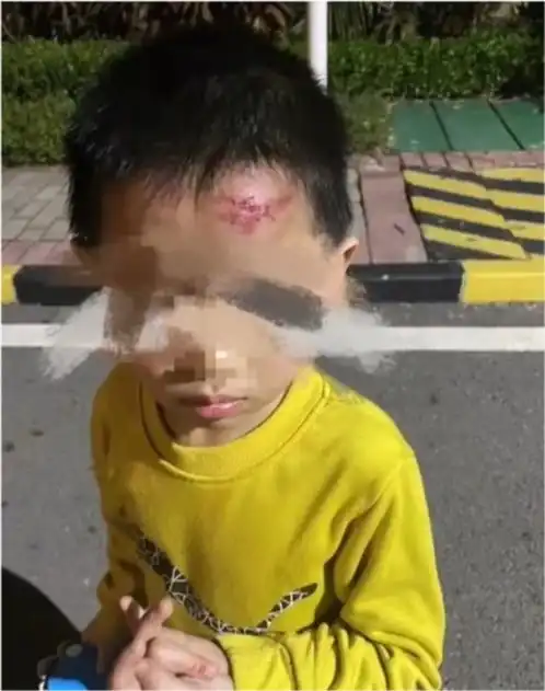 26岁女子连续狠踹5岁男童头部被拘嫌疑人正脸曝光