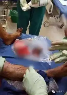 网传潮汕一男子因搞外遇被割掉命根子内附聊天录音