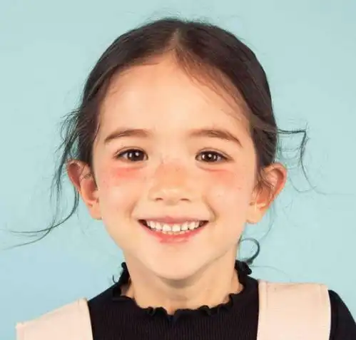 27岁脸上长斑怎么办