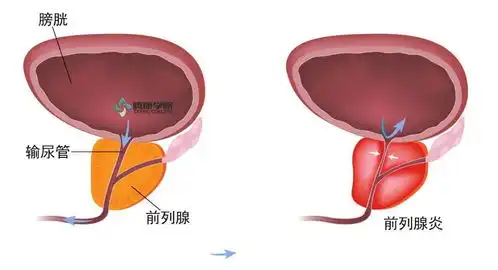 这些病因也可造成内脏痛,知道吗