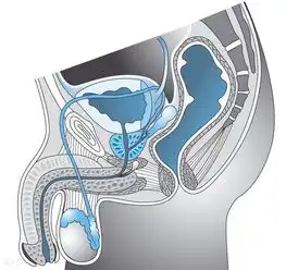 铲除前列腺残余症状,你才是主角