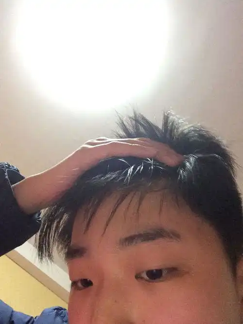 我是男生,为什么我前面的头发一根一根的弧度很大而不像别人那样很短不到眉毛就垂下去了,感觉像贴着头