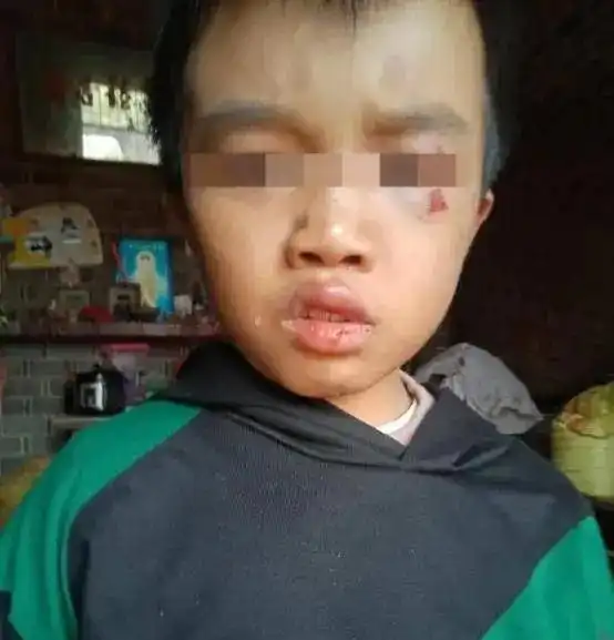 男童重伤惨死家中,事情逐渐败露,亲生父母自首