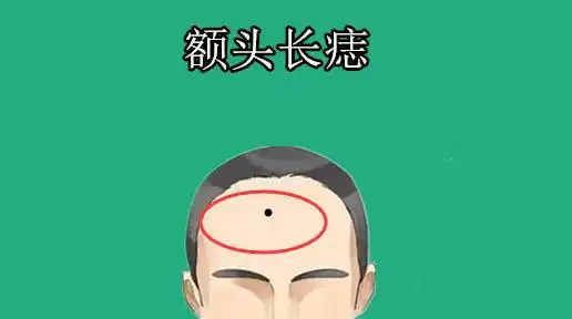 身体4颗富痣,男人旺财,女人旺家,只要一个,少奋斗十年网易订阅