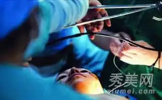 男人如何变成女人曝光变性手术全过程