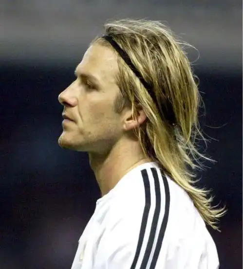 小贝植发两年又秃了秃头是欧美男人永远的痛,亚洲男人就好多了