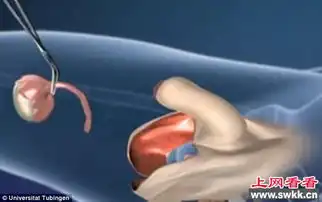 揭秘人妖变性图解变性手术男变女全过程