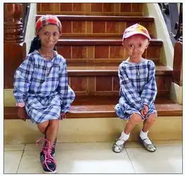 14岁女孩患小头症仅重21斤揭全球怪病