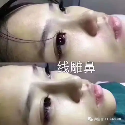 纹在眉头,美尚心头